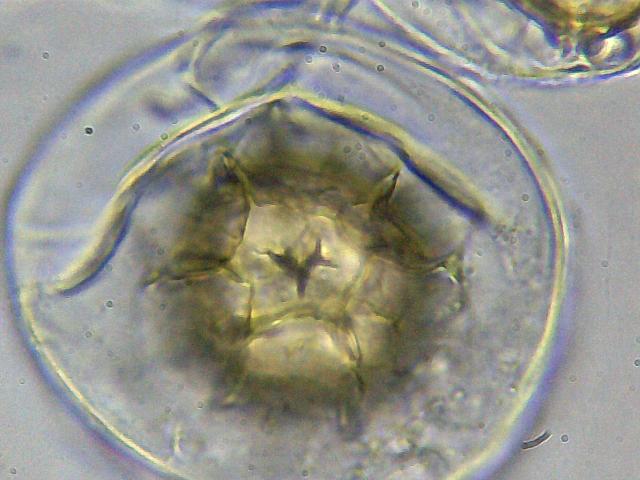 Tuber aestivum dalla fotografia alla microscopia